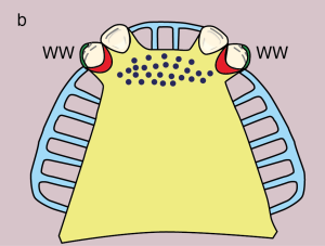 Figure 11.10. b) Metal framework design.