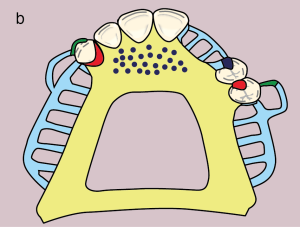 Metal framework design.