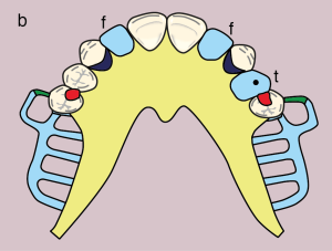 Metal framework design.