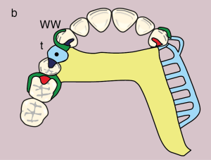 Metal framework design.