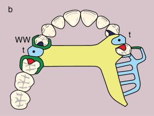 Figure 11.21. b) Metal framework design.