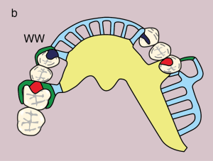 Figure 11.24. b) Metal framework design.