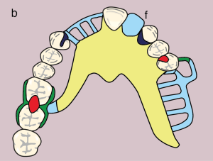 Figure 11.25. b) Metal framework design.