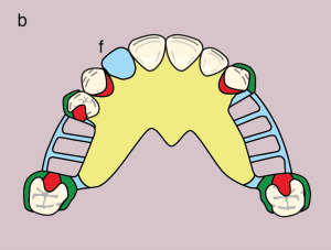Figure 11.28. b) Metal framework design.