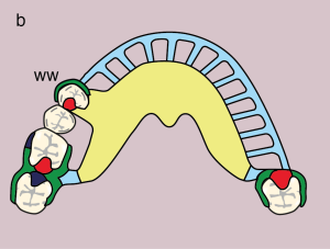 Figure 11.37. b) Metal framework design.