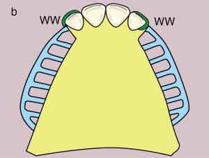 b) Metal framework design.