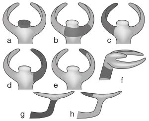 Figure 3-1. Components of a clasp:a) Rest: Provides support to the denture by engaging the abutment tooth. b) Body: Connects the rest and clasp arms to the minor connector. c) Reciprocal arm: Located above the survey line, it provides stabilization. d) Retentive arm: Includes both the shoulder and the terminal retentive tip. e) Retentive tip: The terminal one-third of the retentive arm, located below the survey line, which provides direct retention. f) Minor connector: Joins the clasp body to the metal framework. g) Approach arm: A type of minor connector in bar clasps that connects the body and retentive tip to the framework. h) Retentive tip of a bar clasp: Positioned below the survey line, this part of the bar clasp provides retention.