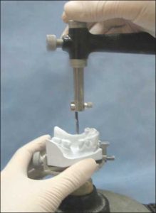 Figure 7-10. During the placement of the cast on the surveyor, the right hand is rested on the horizontal arm while the fingers are used to move the vertical arm upward or downward. The left hand, which holds the cast on the adjustable table, moves it horizontally over the platform in relation to the vertical arm.