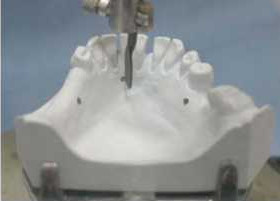 Figure 7-14. a) Recording the cast relation using the three-point method.