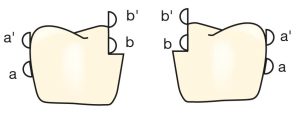 Figure 7-4. The reciprocal arm of the clasp has a greater influence on the path of insertion when placed on a properly prepared cast crown. When the retentive arm (a′) makes initial contact with the buccal surface, the reciprocal arms (b′) simultaneously contact the opposing surfaces of the tooth that have been flattened in parallel. As the retentive arms move from point (a′) to point (a), the reciprocal arms move correspondingly from region (b′) to region (b).