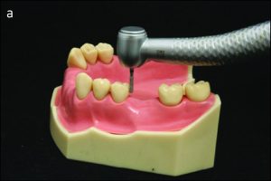 Figure 10-20. a) Anterior