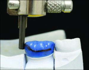 Figure 10-53. A carbon marker is used to draw the survey line.