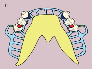 Figure 11.11. a) Metal framework design.