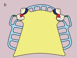 Figure 11.12. b) Metal framework design.