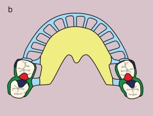Figure 11.34. b) Metal framework design.
