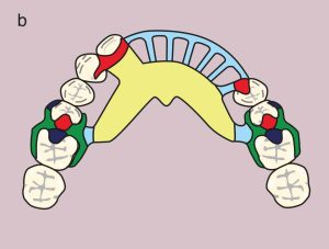 Figure 11.35. b) Metal framework design.