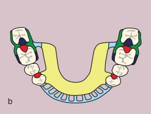 Figure 11.52. b) Metal framework design