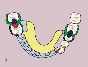 Figure 11.54. b) Metal framework design