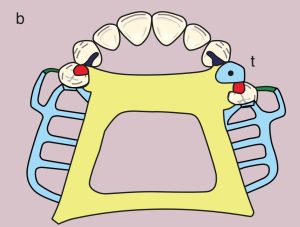 Figure 11.8. b) Metal framework design