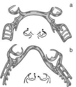 Figure 3-16. Modifications of the Ring Claspa) Reverse-effect clasp: Uses the mesiobuccal undercut. b) Reverse reverse-effect clasp: Uses the mesiolingual undercut.