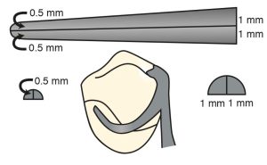 Figure 3-7. The retentive arm of the clasp should taper uniformly toward its terminal end. The thickness of the clasp tip should be approximately half the diameter at its point of origin.