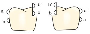 Şekil 7-4. Kroşenin resiprokal kolu, uygun şekilde hazırlanan bir döküm kron üzerine yerleştirildiğinde, giriş yoluna etkisi daha fazla olur. Tutucu kol (a’) bukkal yüzeyle ilk teması oluşturduğunda, resiprokal kollar (b’) da dişin karşıt yüzeyindeki paralel şekilde düzleştirilmiş yüzeyler ile temas eder. Tutucu kollar (a’) noktasından (a) noktasına hareket ederken, resiprokal kollar da (b’) bölgesinden (b) bölgesine hareket eder.