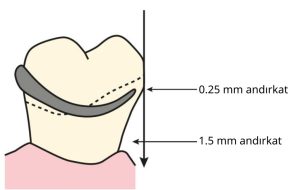 Şekil 8-17. Horizontal andırkat çok geniş olsa bile, gereken andırkat miktarına karar verildikten sonra, tutucu ucun yerleşim bölgesi belirlenir.