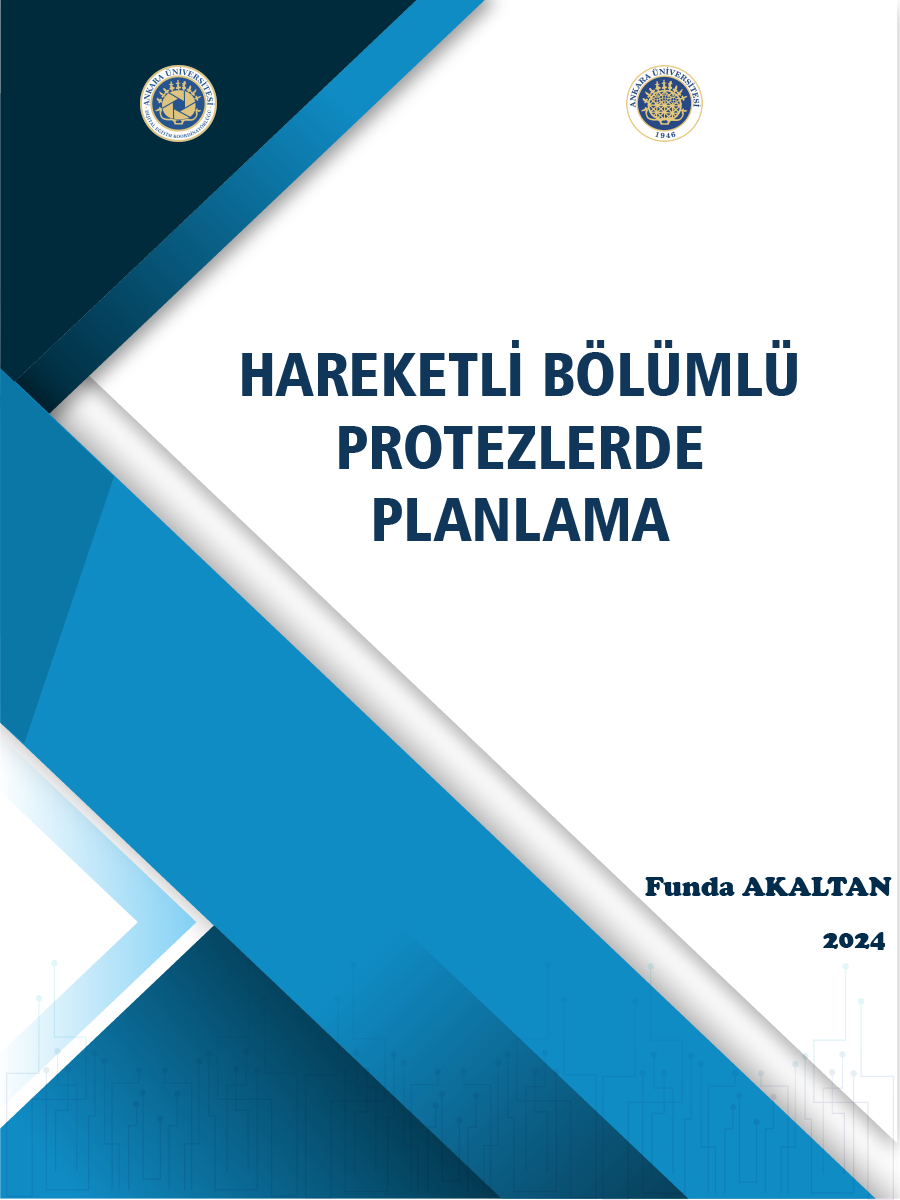 Hareketli Bölümlü Protezlerlerde Planlama için kapak görseli